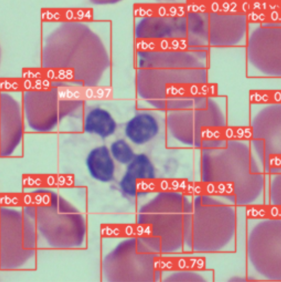 Bloodcell Detection Result
